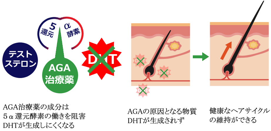 AGA治療薬の作用機序